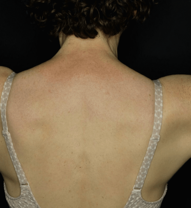Let’s Talk About Bingo Wings – And What You Can Do About Them
