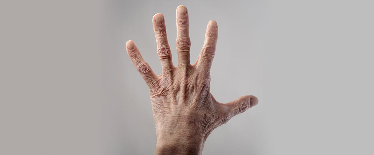 Hand Ageing