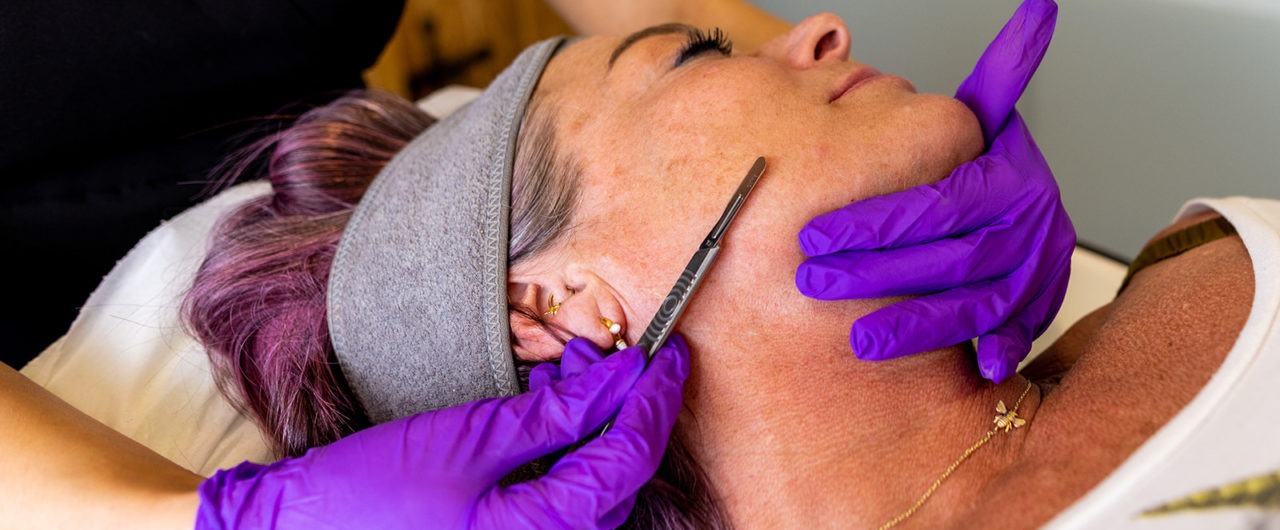 Dermaplaning