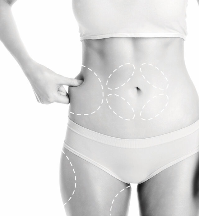 How much does Coolsculpting cost?